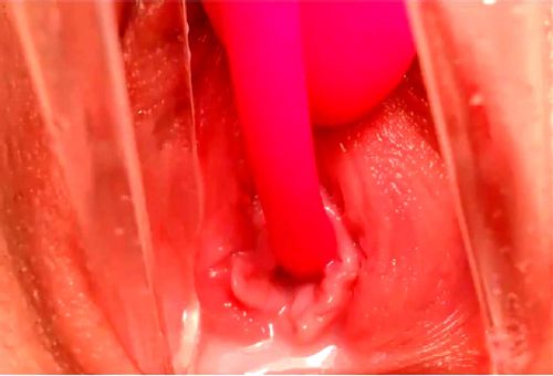 Bail reccomend teen exploring cervix deep vagina speculum