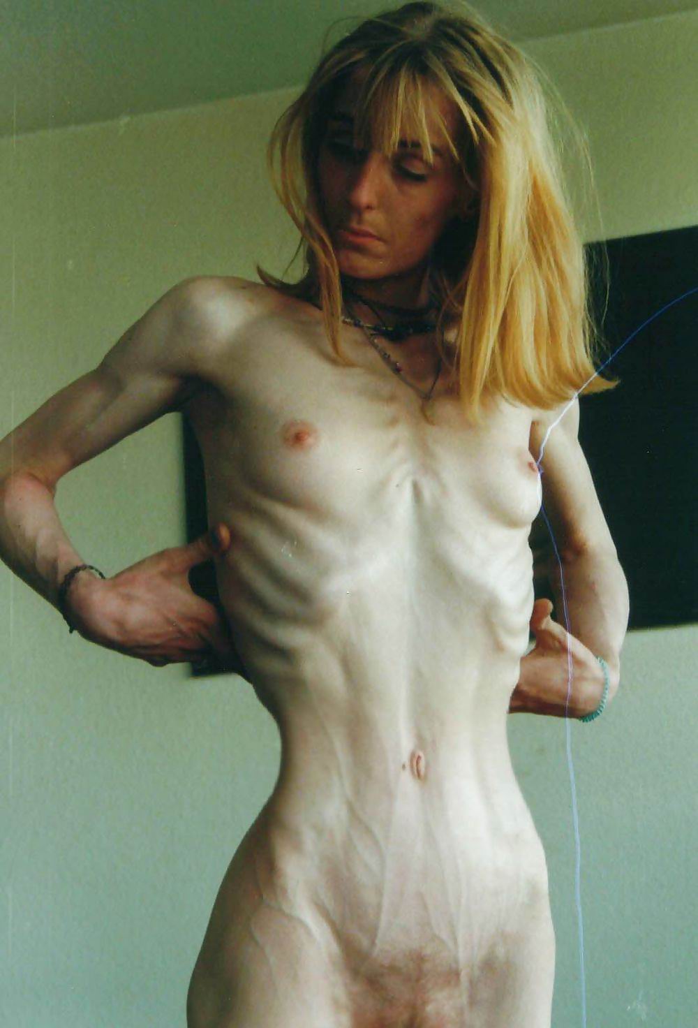 best of Chick anorexic