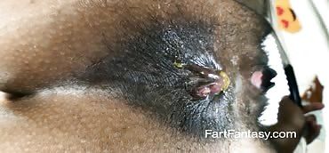 Closeup fart